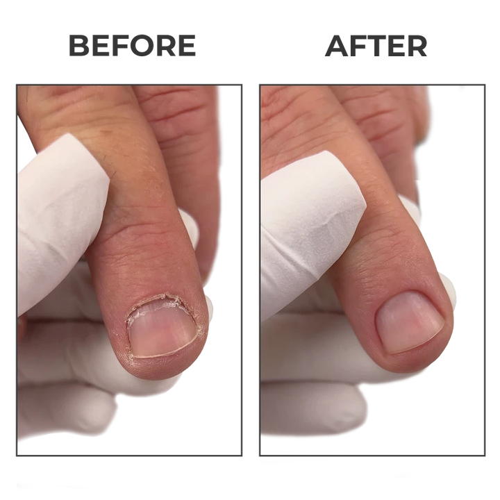 PNB Cuticle Blade, alkaline cuticle remover